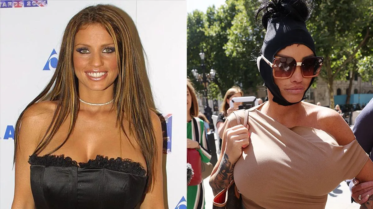 Katie Price's Dramatic Facial Transformation Stuns Followers