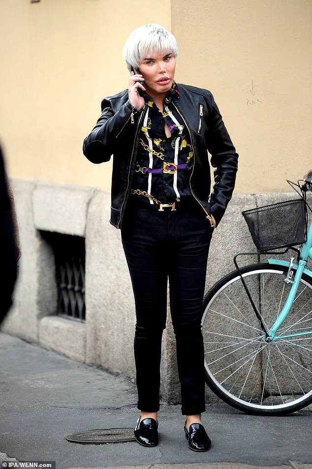 Human Ken Doll Rodrigo Alves in Agony After Chin Implant Ruptures