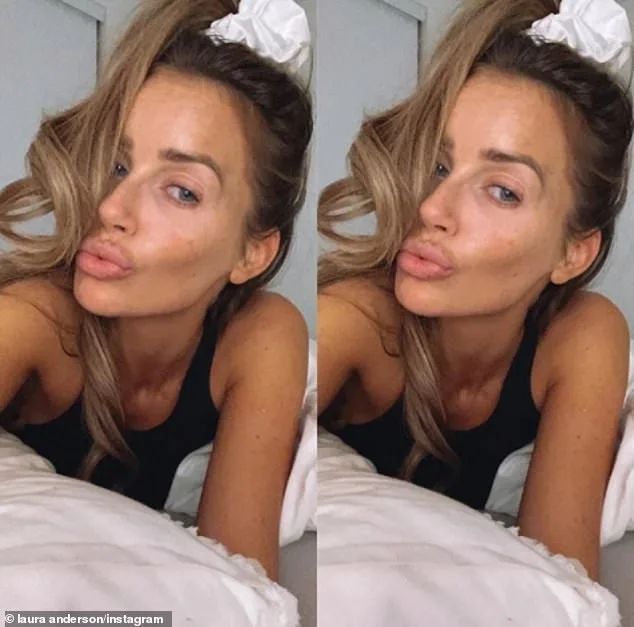 Laura Anderson Shares Filter-Free Selfie Amid Airbrushing Ban Debate