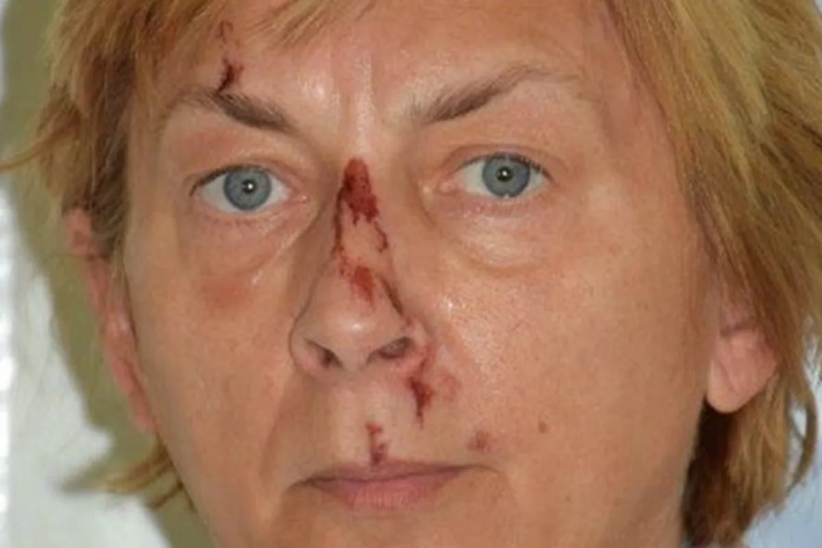 Croatian Police Seek Identity of Mystery Woman Found on Rocks