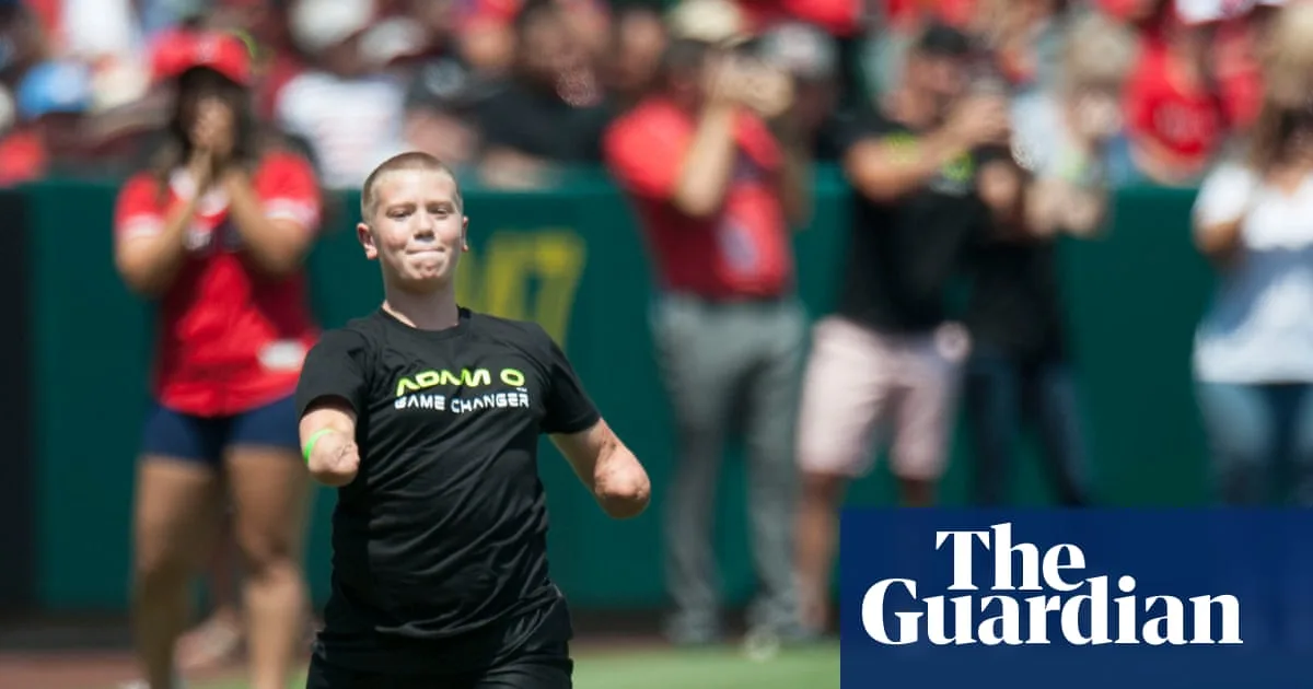 Limbless Cornhole Star Accused Of Murder In Tesla Shooting