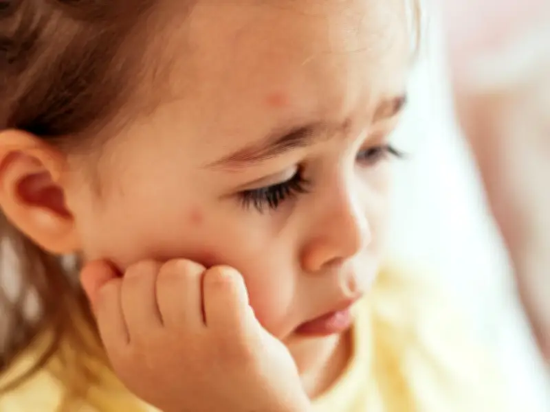 Little-Known Measles Symptom Parents Must Know After Two Children Die