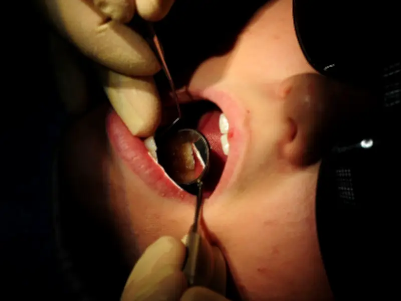 Liverpool Children as Young as Three Need Surgery for Rotten Teeth