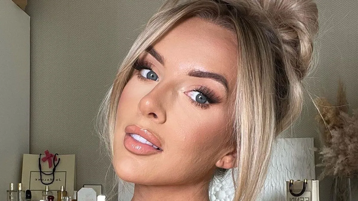 Love Island Star Faye Winter Warns of Botox Dangers After Botched Procedure Left Her 'Paralysed'