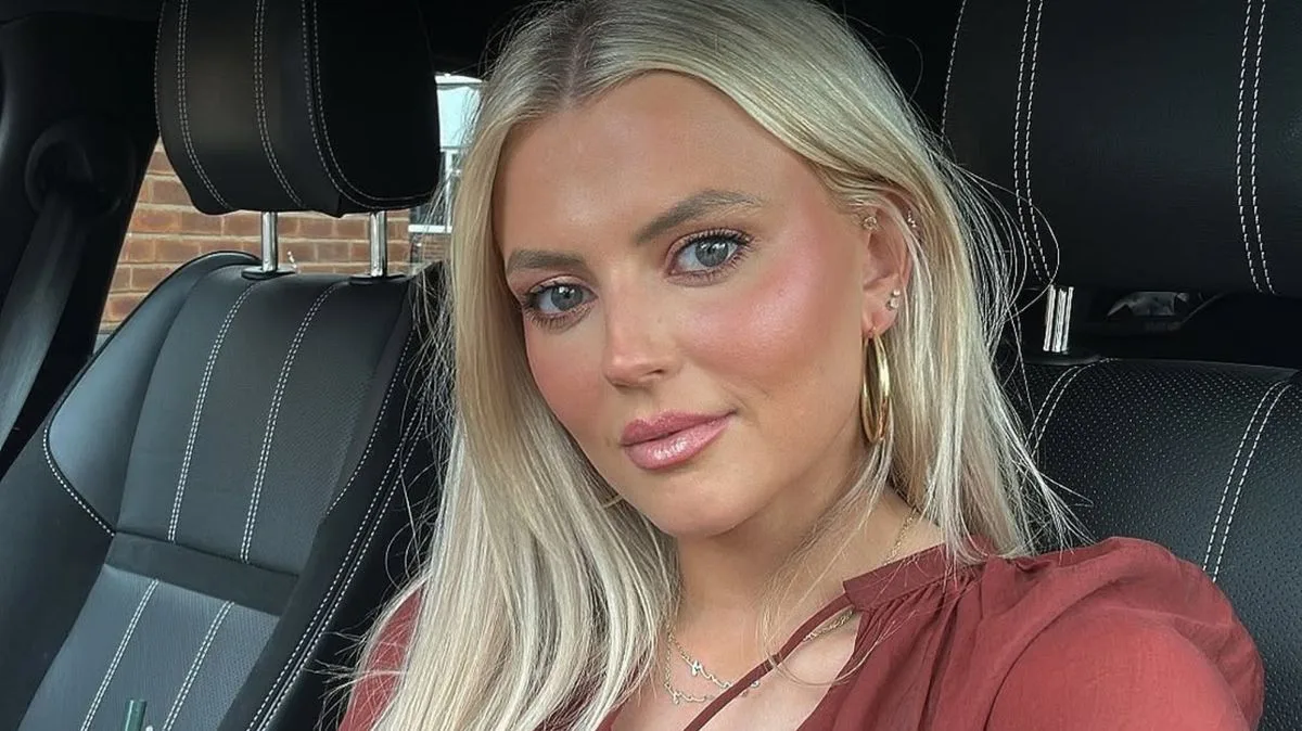Coronation Street's Lucy Fallon Swears by £19 Balm for Contact Dermatitis Relief