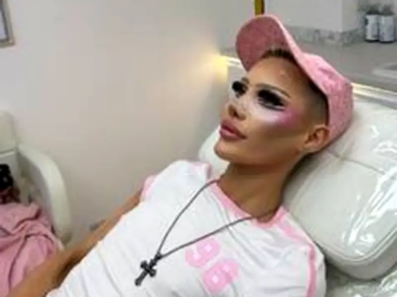 Man, 25, spends £30k on surgery to become 'alien Barbie doll'