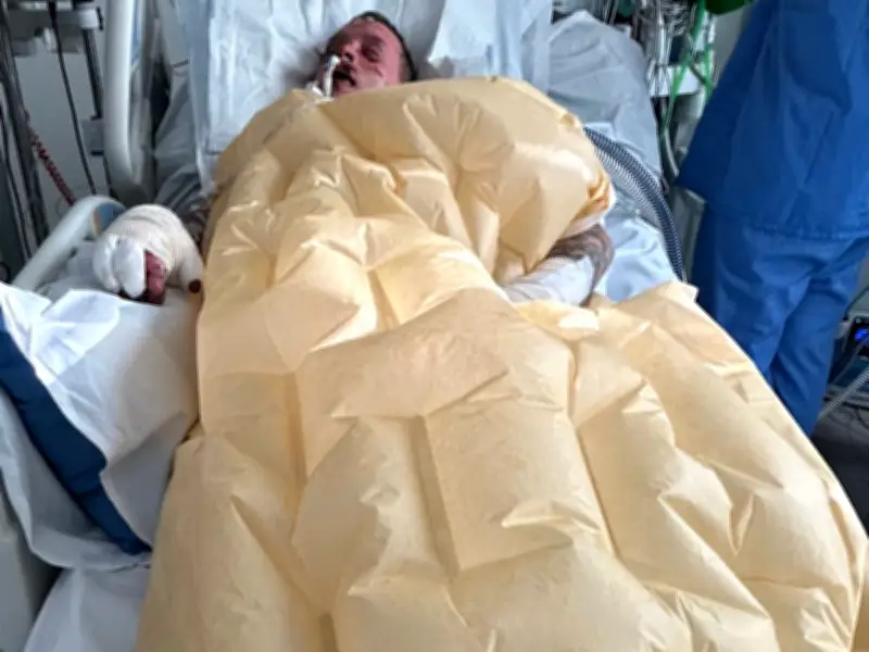 Man in Coma for Five Weeks After Gin-Making Explosion