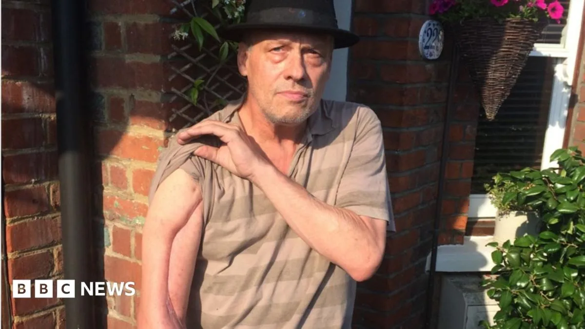 False widow spider bite leads to life-threatening infection for St Albans man