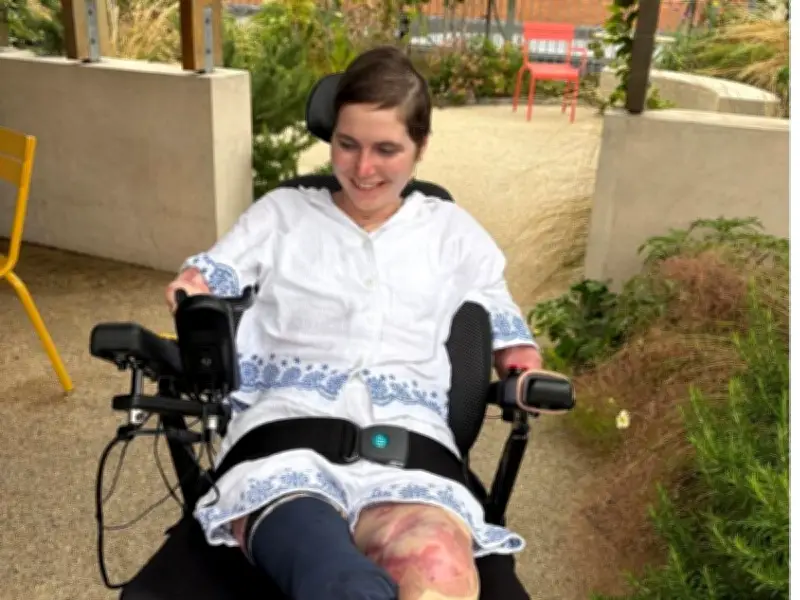 Medical Student Lily McGarry Becomes Quadruple Amputee After Sore Throat