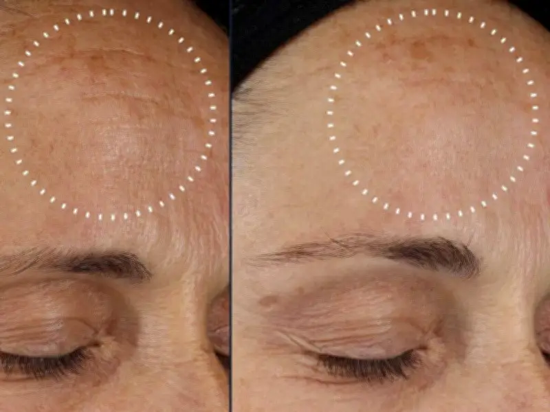 Medik8 Crystal Retinal 3 Serum Hits Lowest Price in Amazon Prime Day Deal