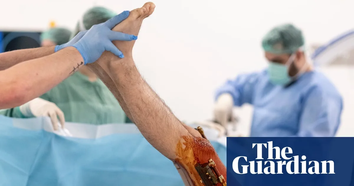 Men Paying Thousands to Break Legs for Height Gain: Is It Worth It?