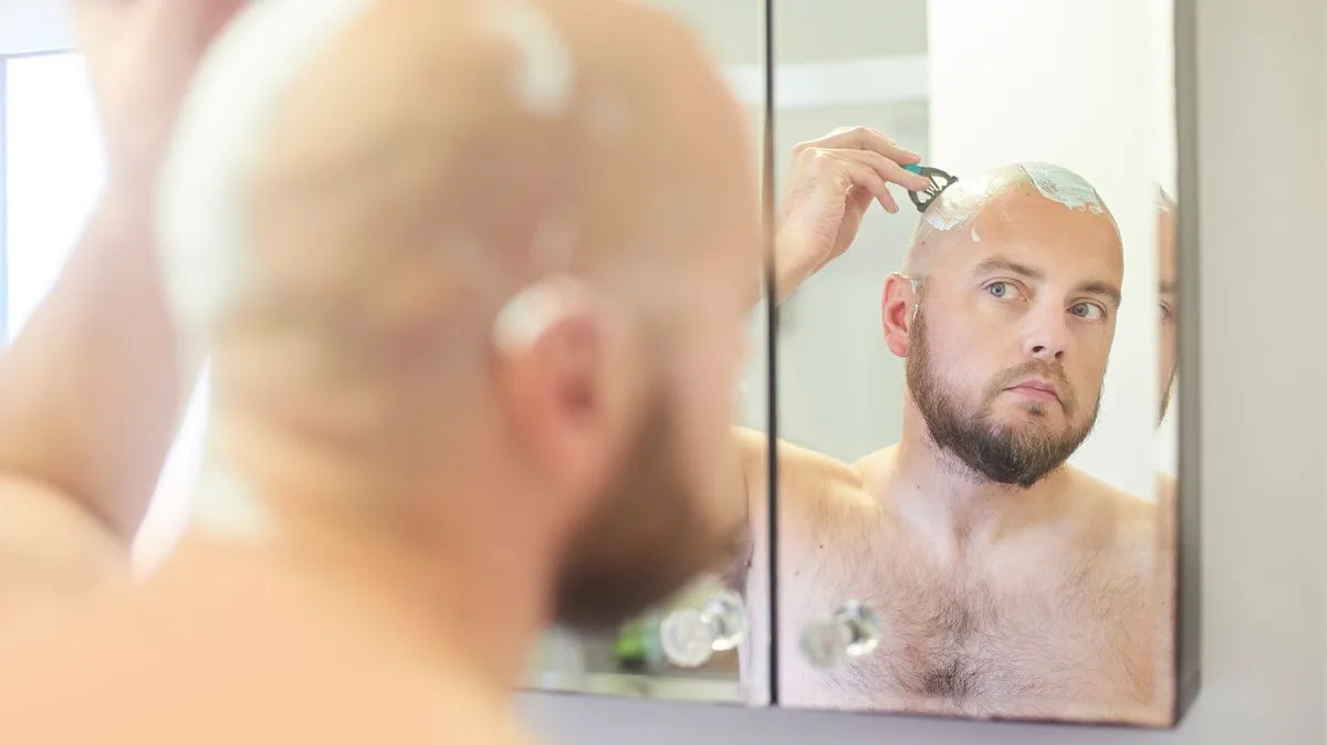 Men Who Shave Heads to Cope with Hair Loss Say Problems Fade