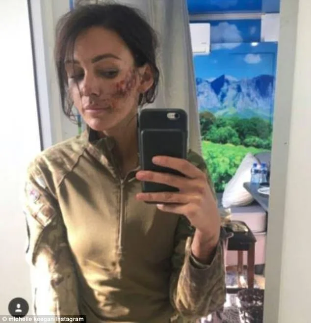 Michelle Keegan Shares Bloodied and Bruised Selfie from Our Girl Set After Fans Slammed Her 'Flawless' Warzone Look
