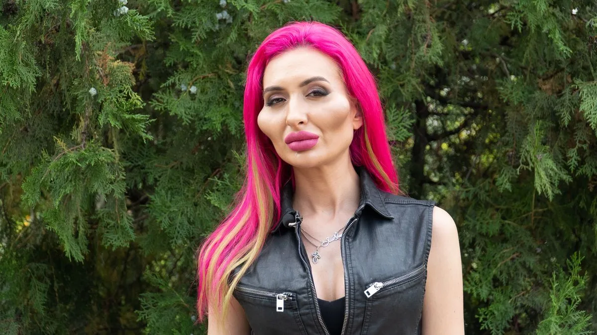 Model with 'world's biggest cheeks' shows dramatic transformation from gym enthusiast nine years ago