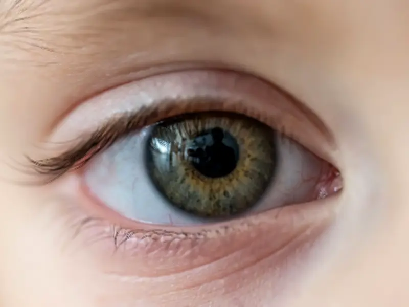 Mum Urged to See Doctor After Tick Found on Toddler's Eyelid