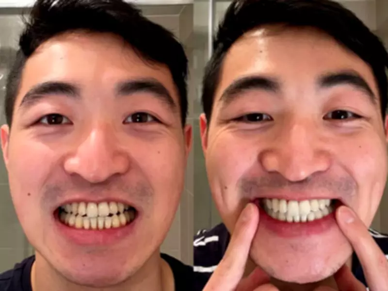 MySweetSmile Bundle: 6p-a-Day Whitener Transforms Teeth in Days