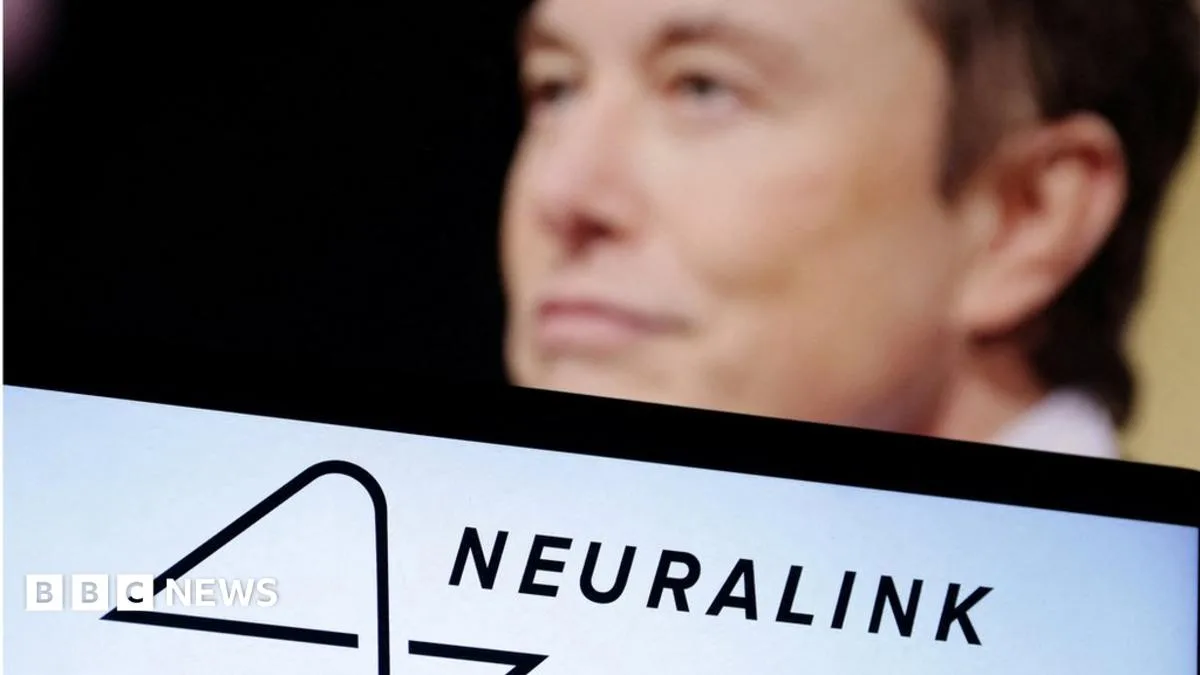 Neuralink Seeks UK Participants for Brain Implant Trial