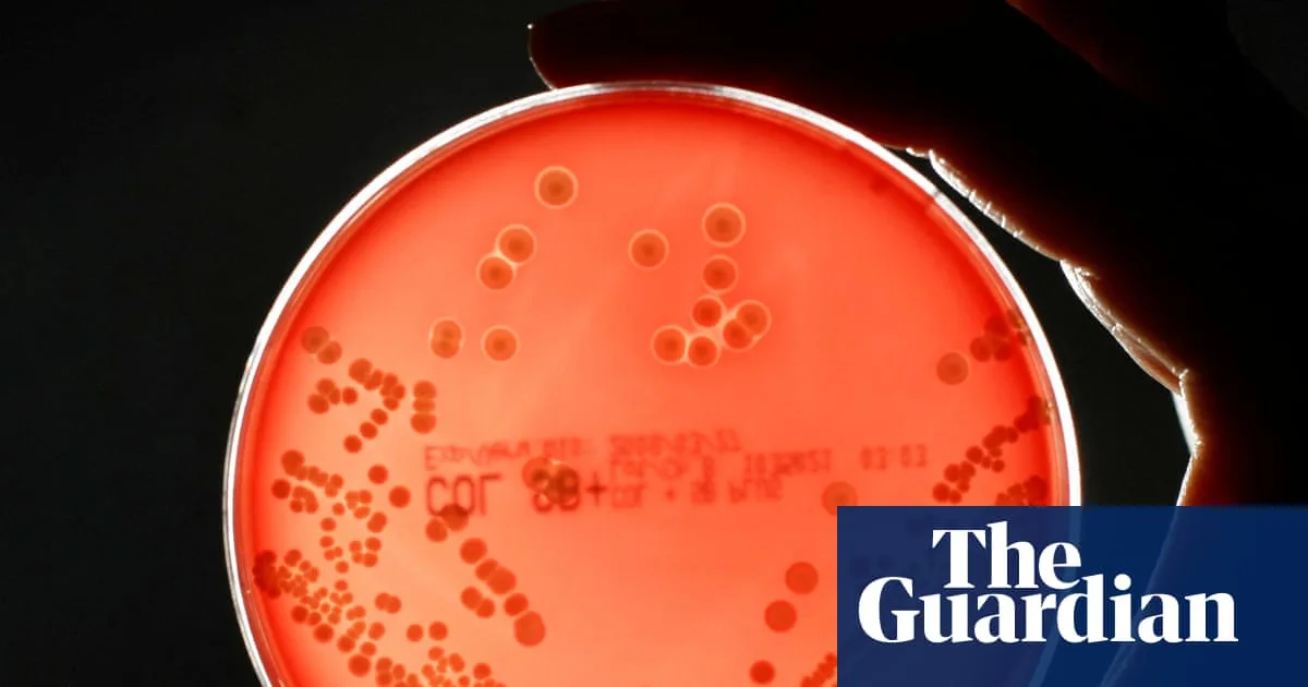 Deaths Linked to Antibiotic-Resistant Superbugs Rise 17% in England