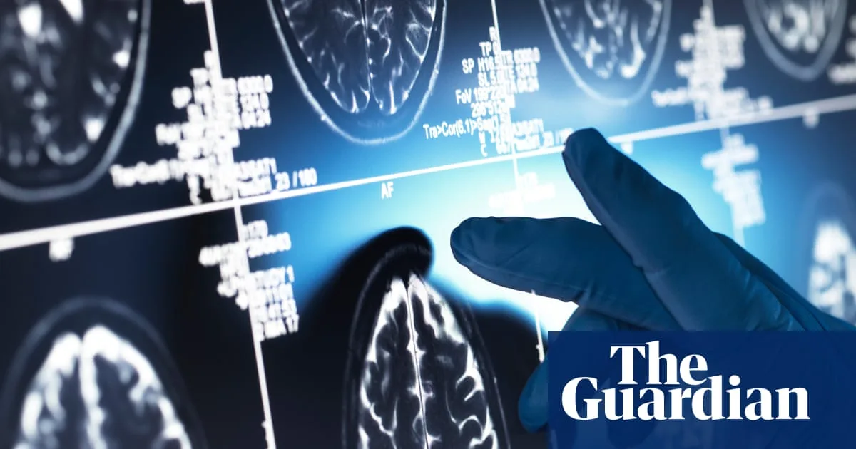 Review Finds 'Trivial' Effect of Alzheimer's Drugs, Casting Doubt on 'Gamechanger' Claims