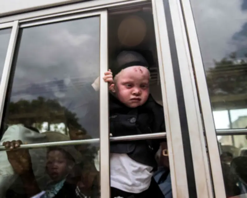 Nigerian with albinism deported under Trump asylum crackdown