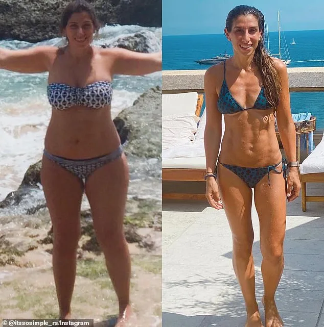 Mother-of-three proud of 'wiggly, magical' belly after losing 130lbs, then opts for tummy tuck