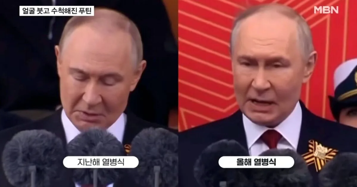 Putin's Swollen Face Sparks Health Concerns