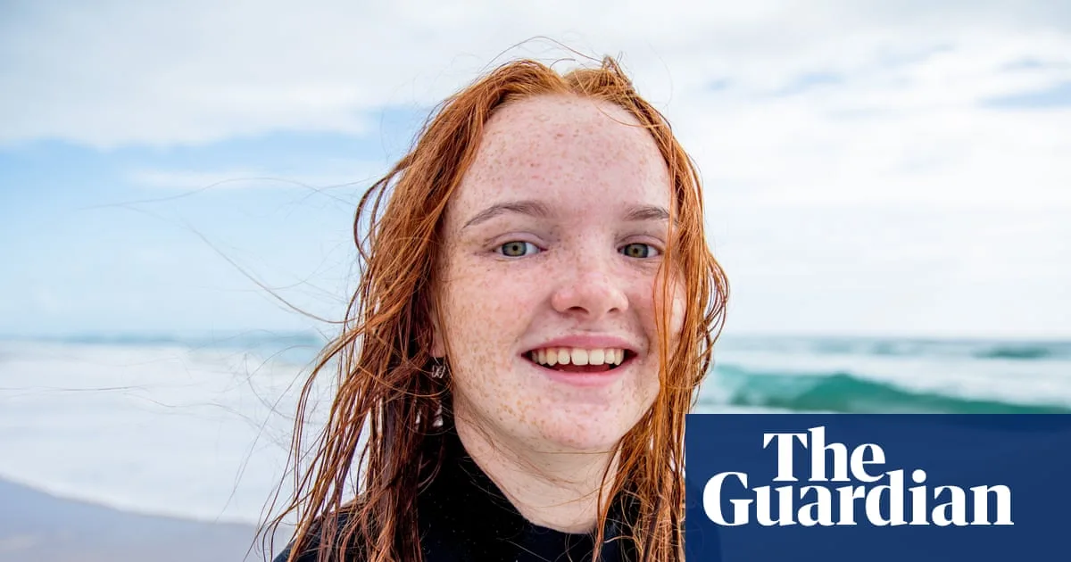 Red Hair Gene Favoured by Natural Selection Over Last 10,000 Years, Harvard Study Finds