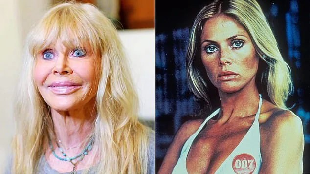 Britt Ekland Warns Against Cosmetic Injections: 'It Ruined My Career'