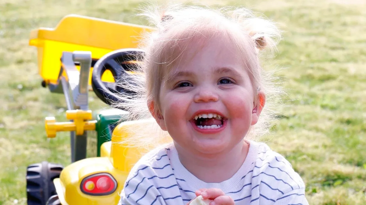 Sanfilippo Syndrome: The Tragedy of ‘Childhood Dementia’ and Early Warning Signs