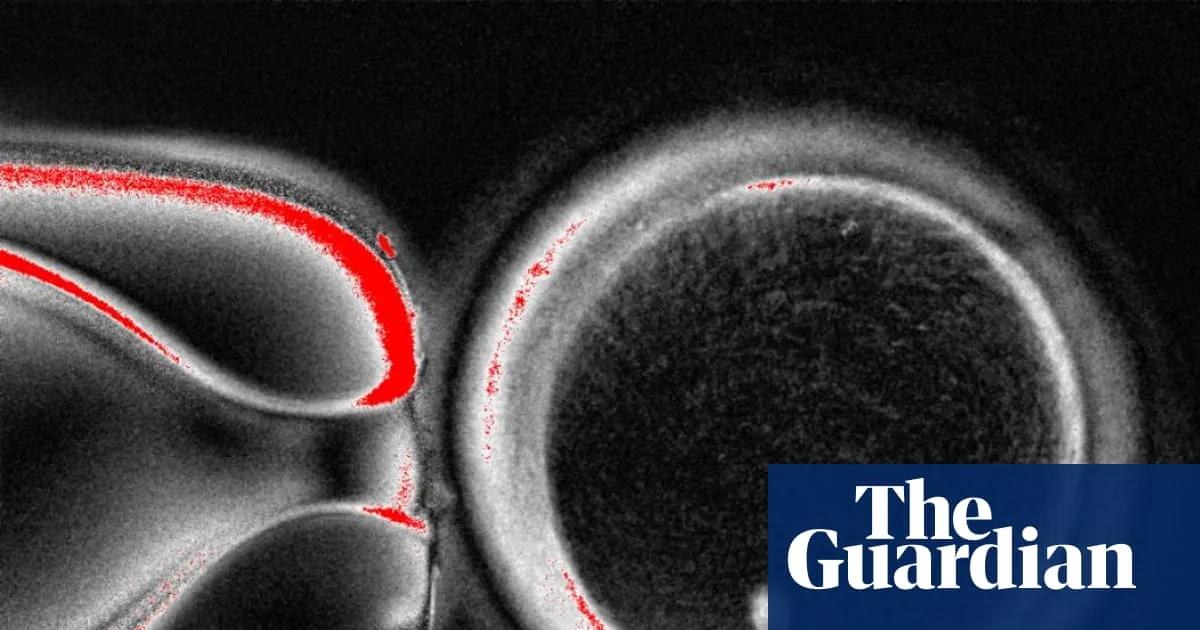 Human Eggs Created from Skin Cells in Fertility Breakthrough