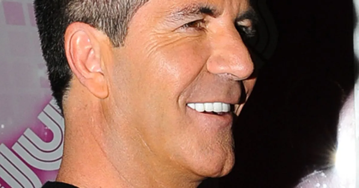 Simon Cowell Reveals Real Reason For BGT Absence