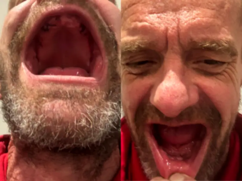 Smile restored: London dad’s journey from embarrassment to confidence after full mouth dental treatment in Turkey