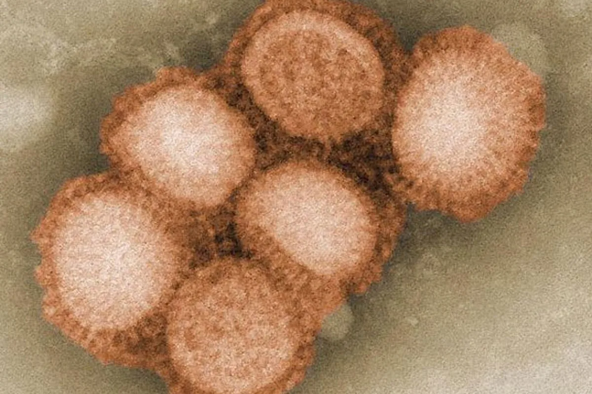 Spain Reports Suspected Human-to-Human Swine Flu Spread