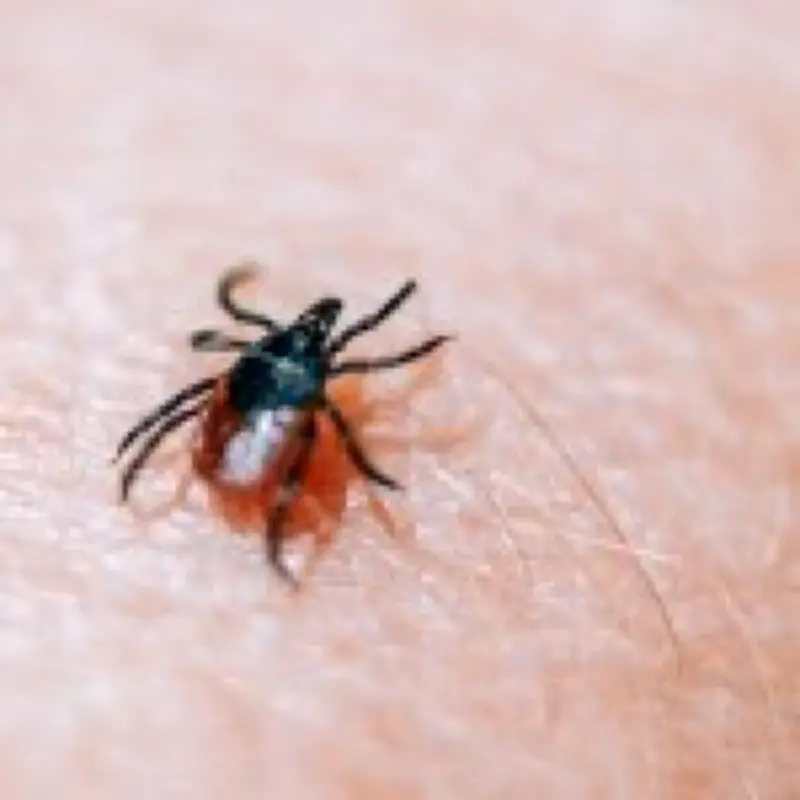 Tick Bite Could Cause Life-Threatening Meat Allergy, Experts Warn