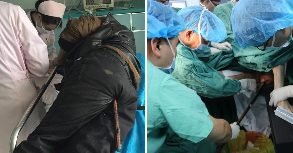 Chinese Construction Worker Survives Impalement by Steel Rod