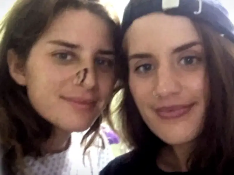 Twins Who Fought Crocodiles Lead Campaign to Save Species