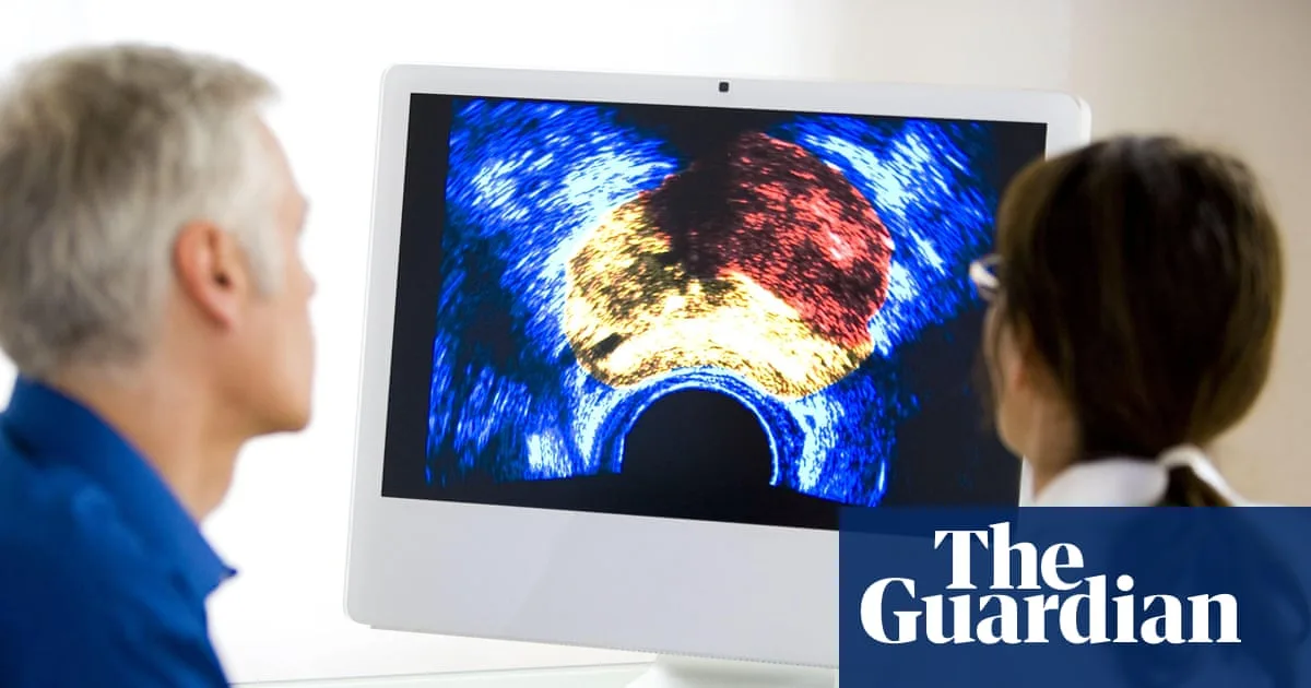 UK Experts Reject Mass Prostate Cancer Screening