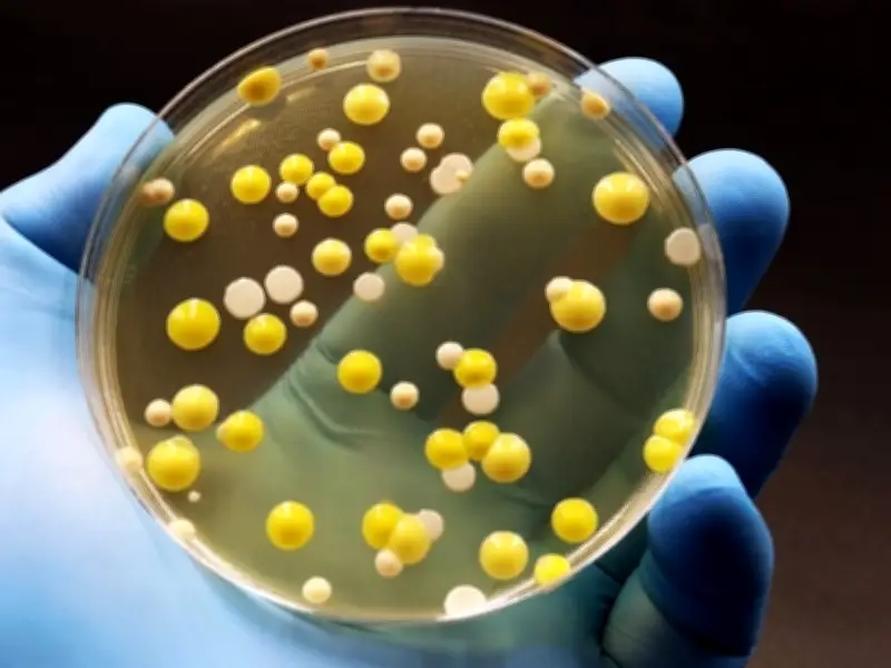UK Hot Tub Owners Warned of Legionnaires' Disease Risk During Heatwave