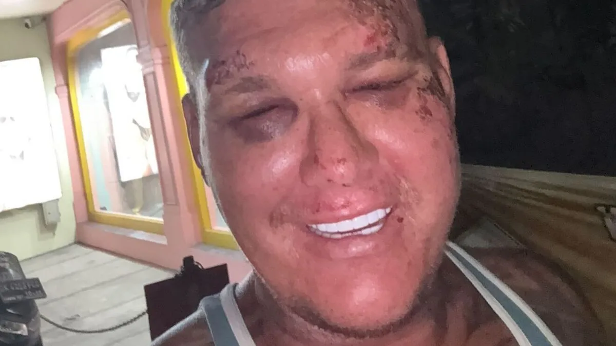 UK tourist drugged, attacked and robbed of £1,800 in Bali nightclub