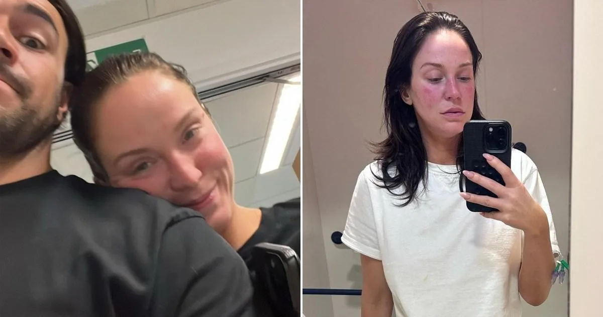 Vicky Pattison Apologises for 'Graphic' Hospital Bed Photo After Health Scare