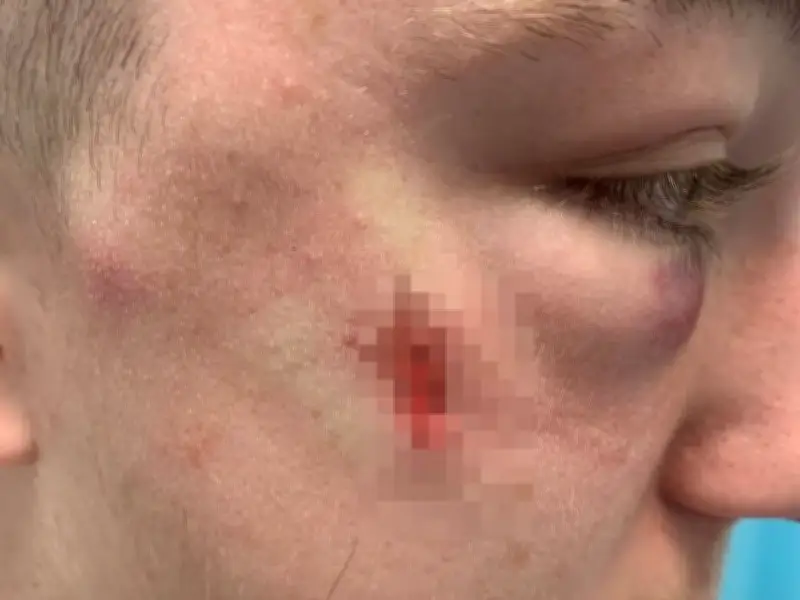 West Lothian teen attacked with hammer at bus stop, suffers broken eye socket