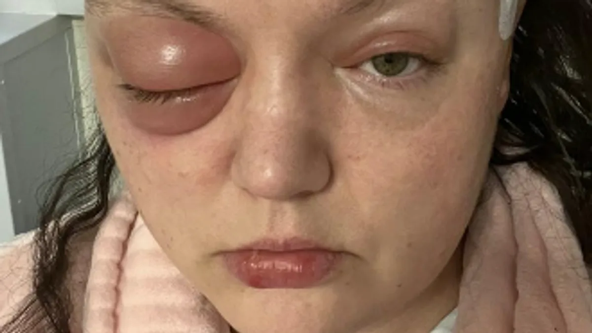 Scots Woman Sues Pfizer Over Brain Tumour Linked to Contraceptive Jab