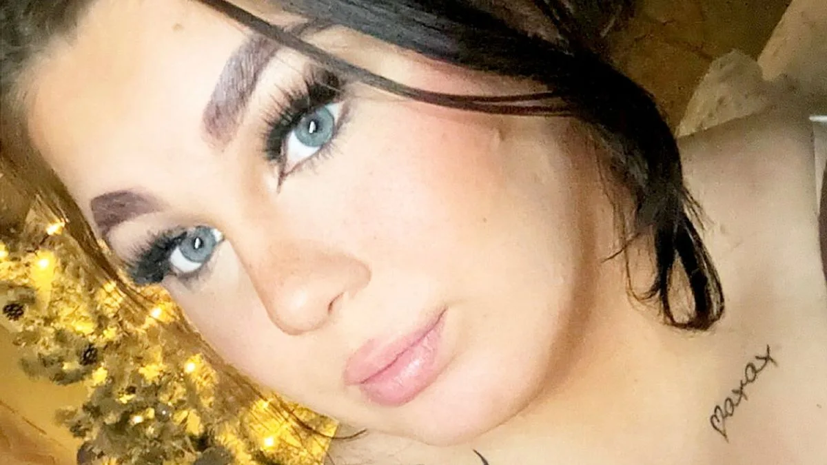 Woman with 36NN breasts denied NHS reduction surgery despite sepsis risk
