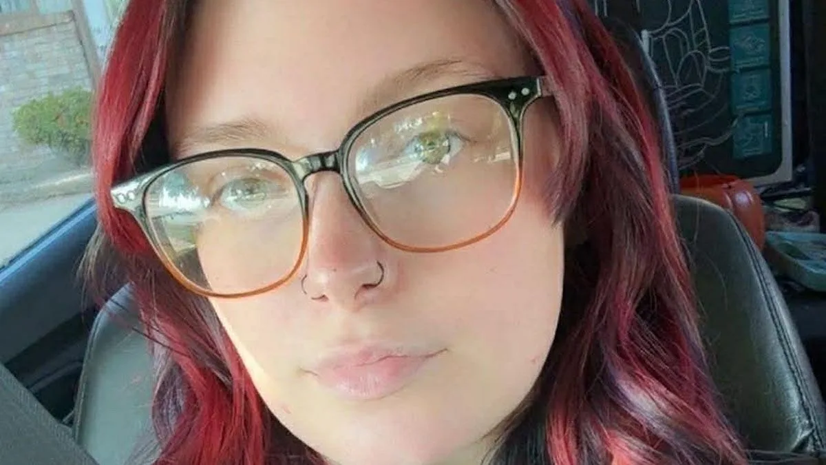 Woman's Face Mauled by Dog During Seizure Revealed on FaceTime