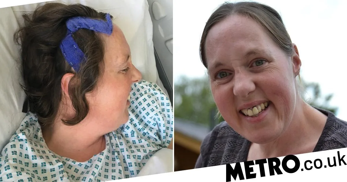 Woman Mistook Brain Tumour Symptoms for Sunstroke