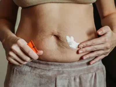 Doctor's Cream Advice to Prevent Chafing and Heat Rash in UK 40C Heatwave