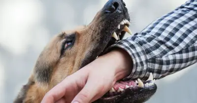 Vet names 3 dog breeds most likely to bite: not pit bulls or Rottweilers