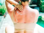 1 in 5 Brits Believe Sunburn Necessary for Tan, Bupa Study Finds