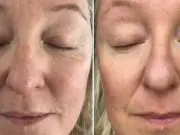 74-Year-Old Credits 84p-a-Day Drink for Wrinkle-Free Skin