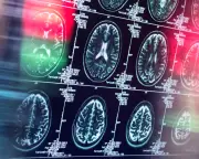 Antidepressants and Antipsychotics Could Replace Opioids for Pain, Study Finds
